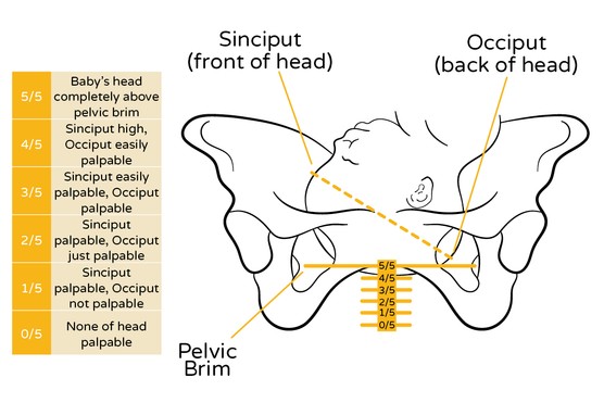 graphic of midwife chart showing stages of baby's head engagement in pelvis