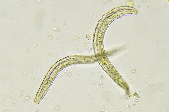 threadworms under a microscope